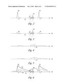 METHOD AND APPARATUS FOR ADJUSTING CARDIAC EVENT DETECTION THRESHOLD BASED     ON DYNAMIC NOISE ESTIMATION diagram and image