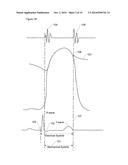 Method and Apparatus for Identifying Cardiac Risk diagram and image