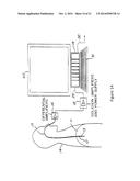 Method And System For Quantifying Timing Discrepancies Between Inspiratory     Effort And Ventilatory Assist diagram and image