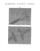 OCCLUSION DEVICE FOR CLOSING ANATOMICAL DEFECTS diagram and image