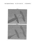 OCCLUSION DEVICE FOR CLOSING ANATOMICAL DEFECTS diagram and image