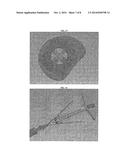 OCCLUSION DEVICE FOR CLOSING ANATOMICAL DEFECTS diagram and image