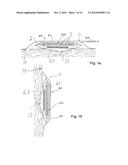 WOUND CARE ARTICLE FOR EXTRACTION AND CONTROL OF WOUND FLUIDS diagram and image