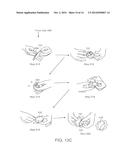 Medicine Delivery Device Having Detachable Pressure Sensing Unit diagram and image