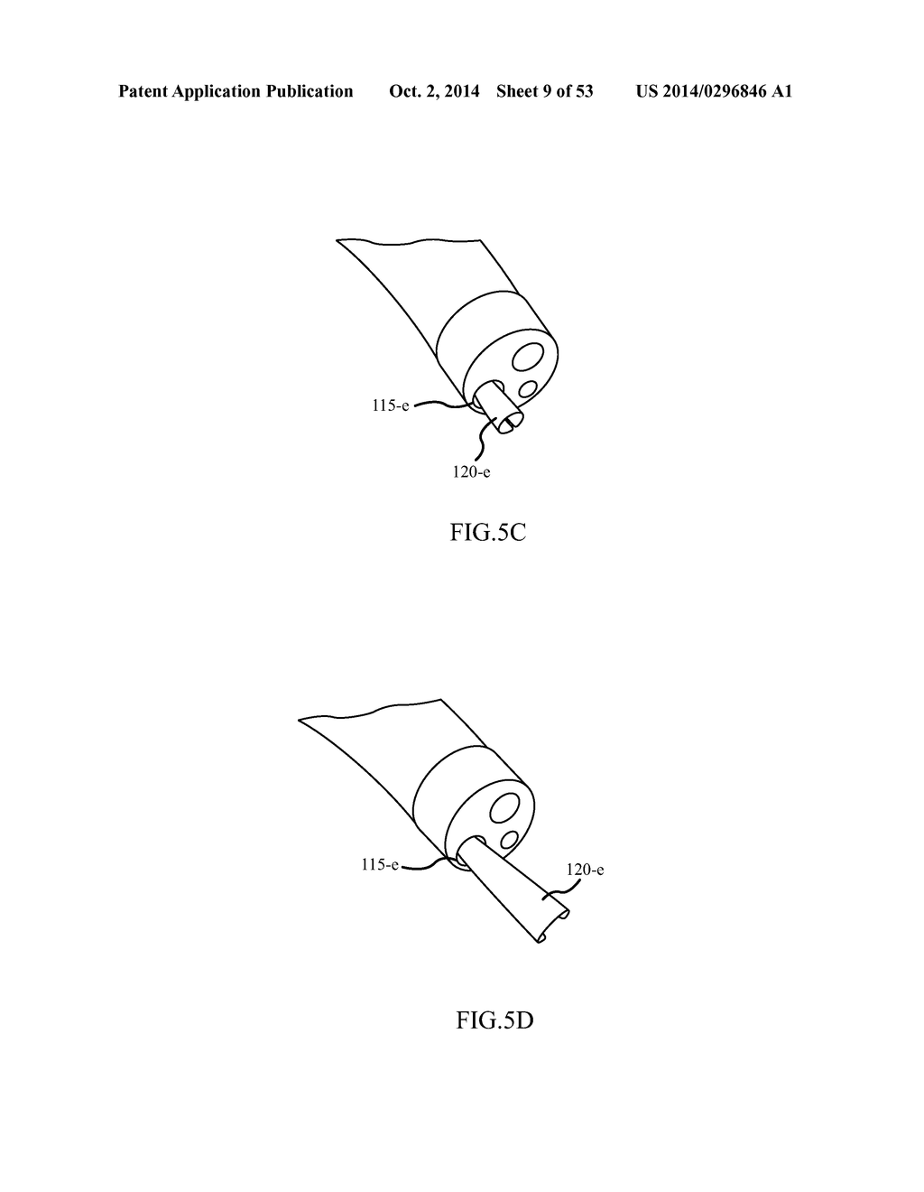 EXPANDABLE SUPPORT STRUCTURE FOR DELIVERY THROUGH A WORKING CHANNEL - diagram, schematic, and image 10