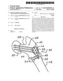 Bone end (epiphysis) fracture fixation device and method of use diagram and image