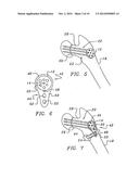 Bone end (epiphysis) fracture fixation device and method of use diagram and image