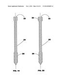 Bone end (epiphysis) fracture fixation device and method of use diagram and image