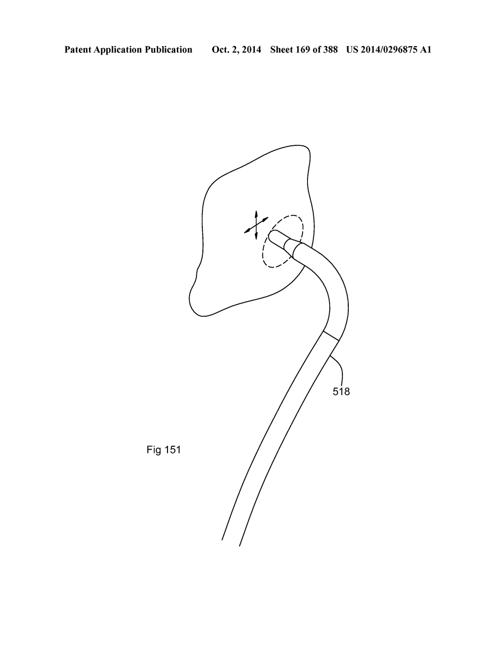 ROBOTIC CATHETER SYSTEM AND METHODS - diagram, schematic, and image 170