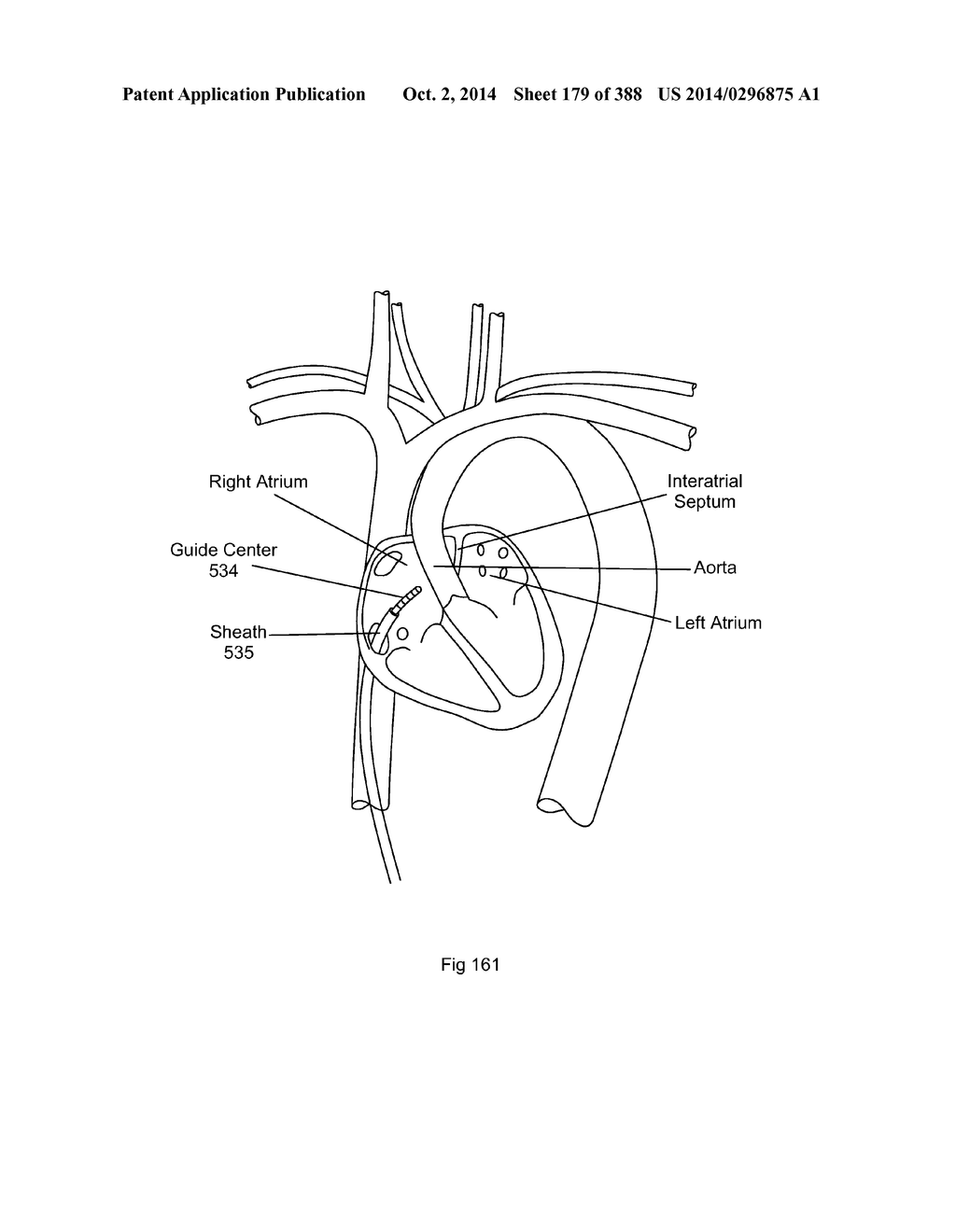 ROBOTIC CATHETER SYSTEM AND METHODS - diagram, schematic, and image 180