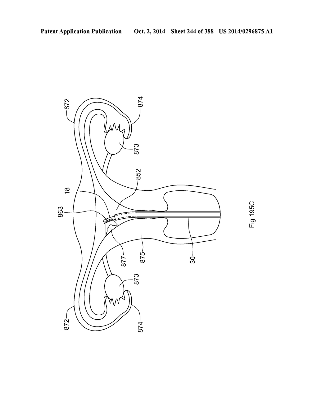 ROBOTIC CATHETER SYSTEM AND METHODS - diagram, schematic, and image 245