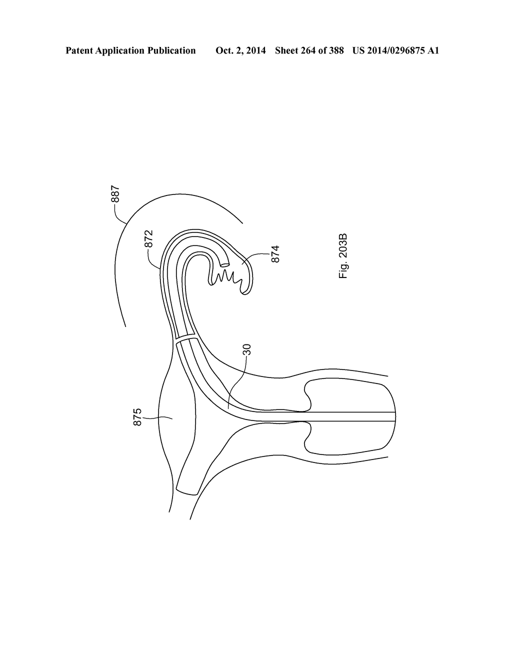 ROBOTIC CATHETER SYSTEM AND METHODS - diagram, schematic, and image 265