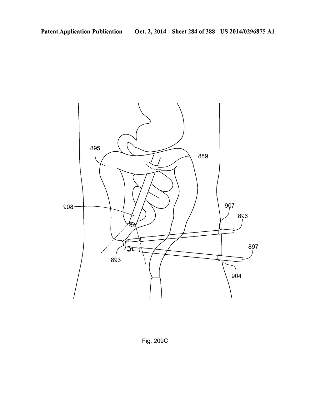 ROBOTIC CATHETER SYSTEM AND METHODS - diagram, schematic, and image 285