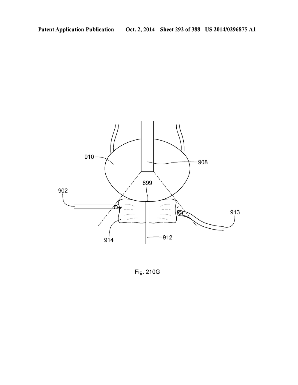 ROBOTIC CATHETER SYSTEM AND METHODS - diagram, schematic, and image 293