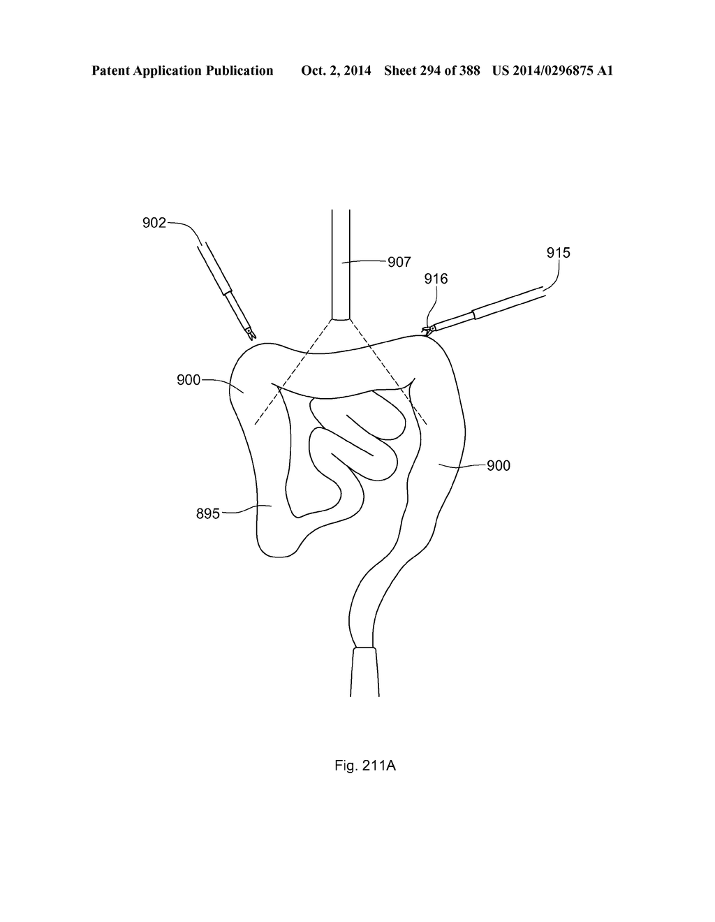 ROBOTIC CATHETER SYSTEM AND METHODS - diagram, schematic, and image 295