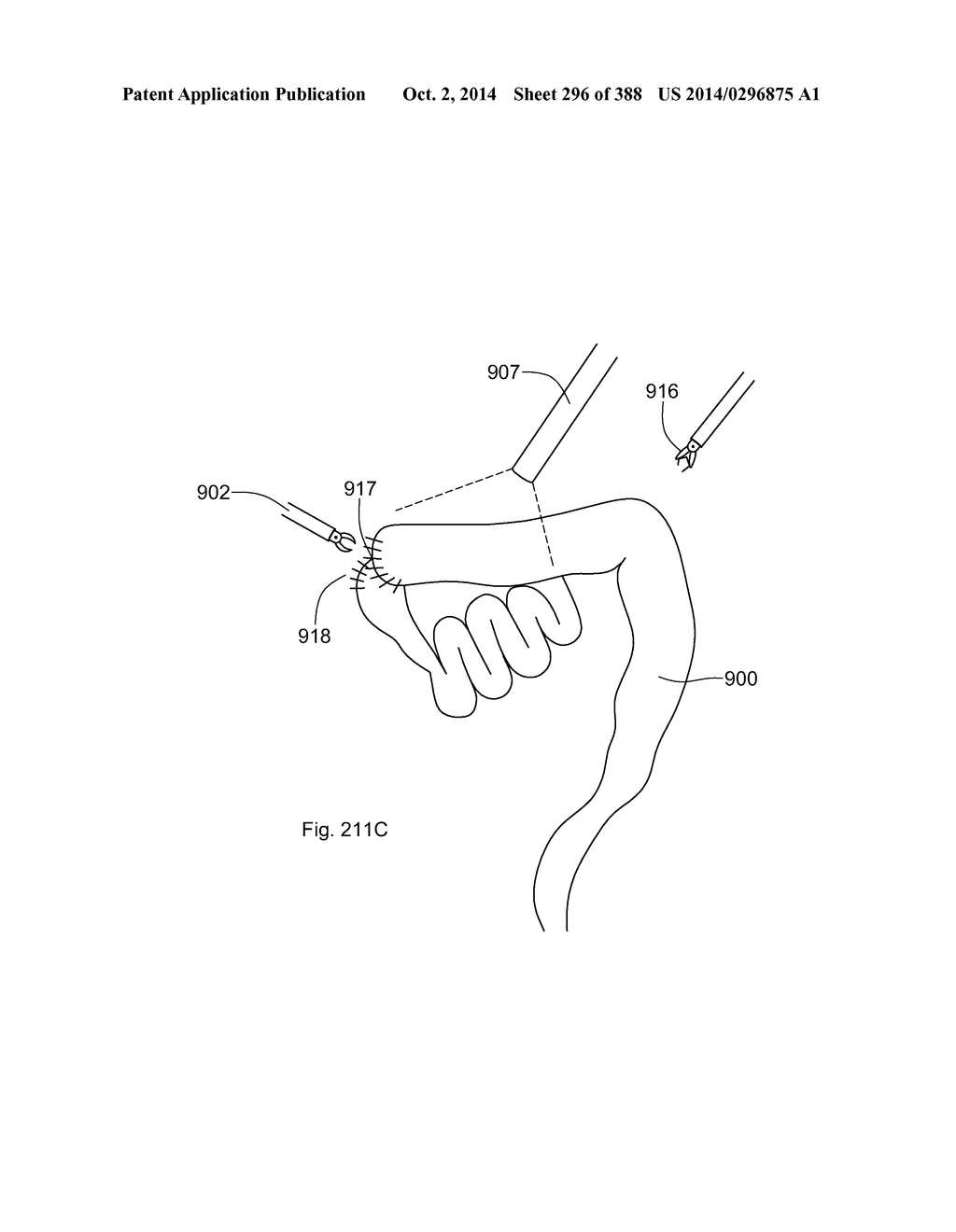 ROBOTIC CATHETER SYSTEM AND METHODS - diagram, schematic, and image 297