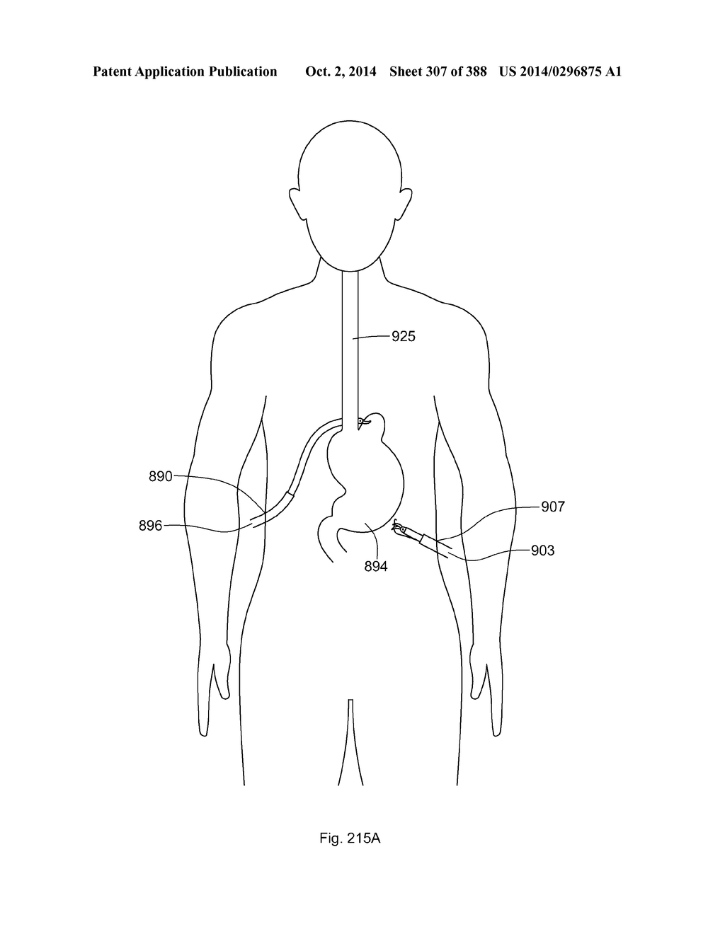 ROBOTIC CATHETER SYSTEM AND METHODS - diagram, schematic, and image 308