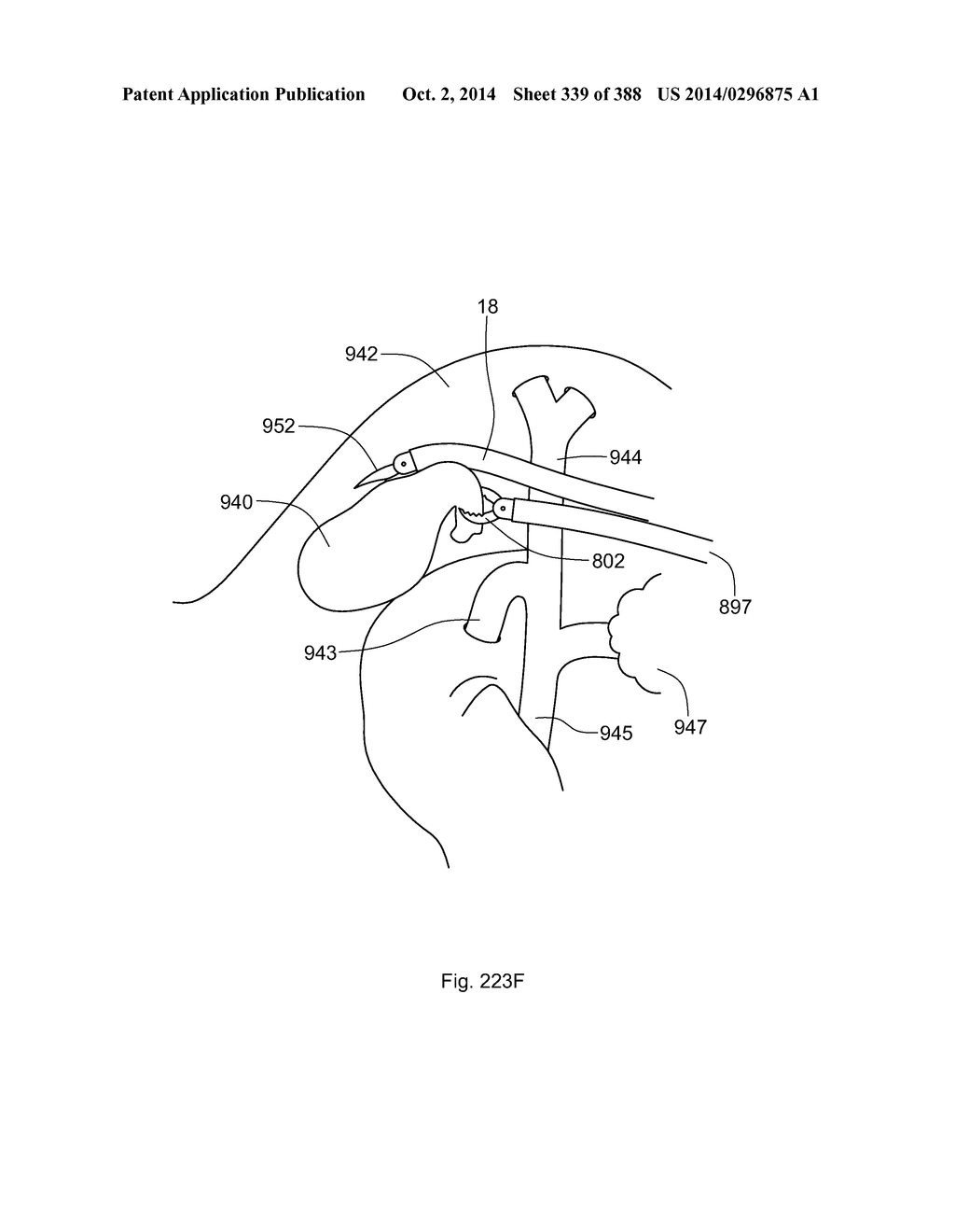 ROBOTIC CATHETER SYSTEM AND METHODS - diagram, schematic, and image 340