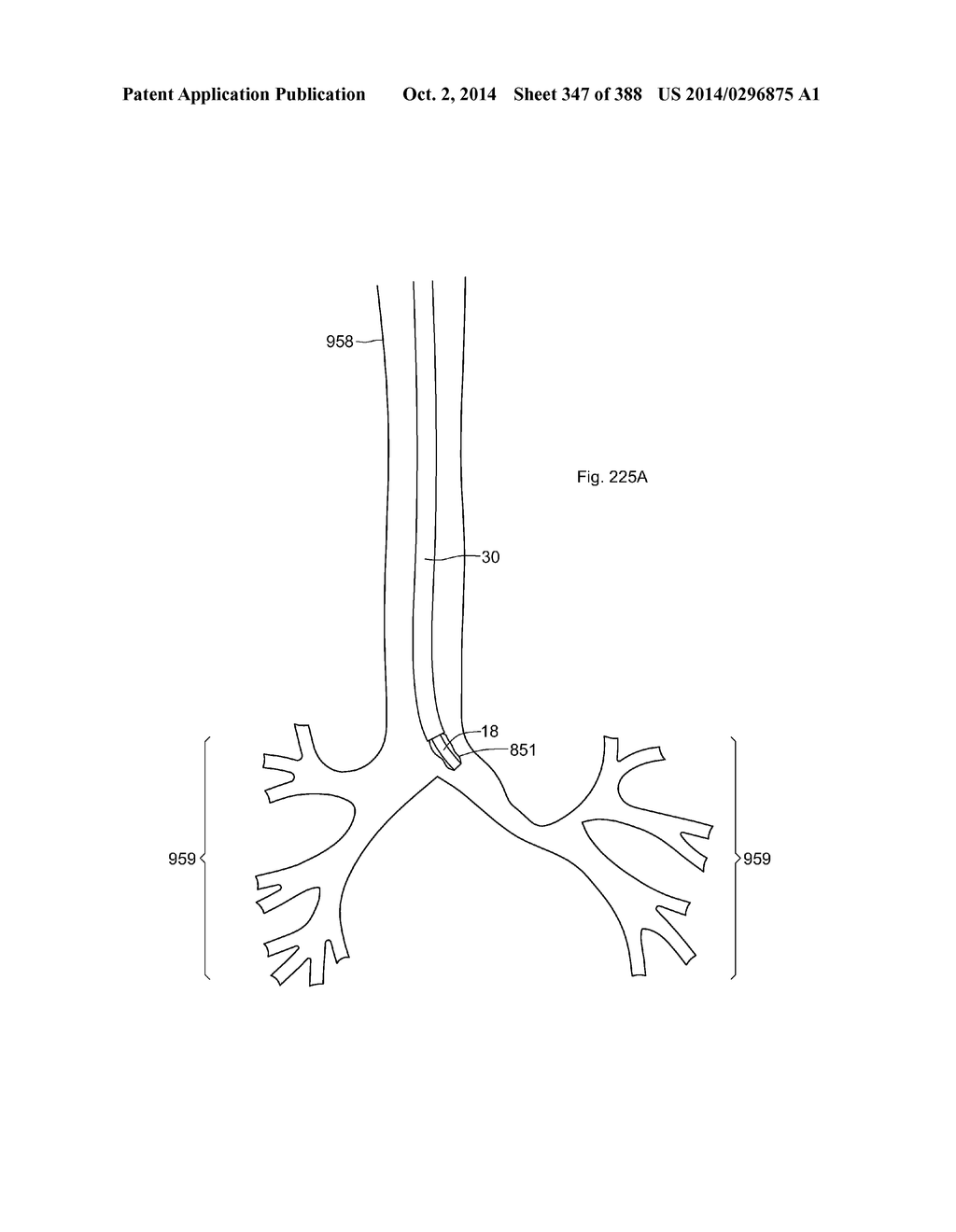 ROBOTIC CATHETER SYSTEM AND METHODS - diagram, schematic, and image 348