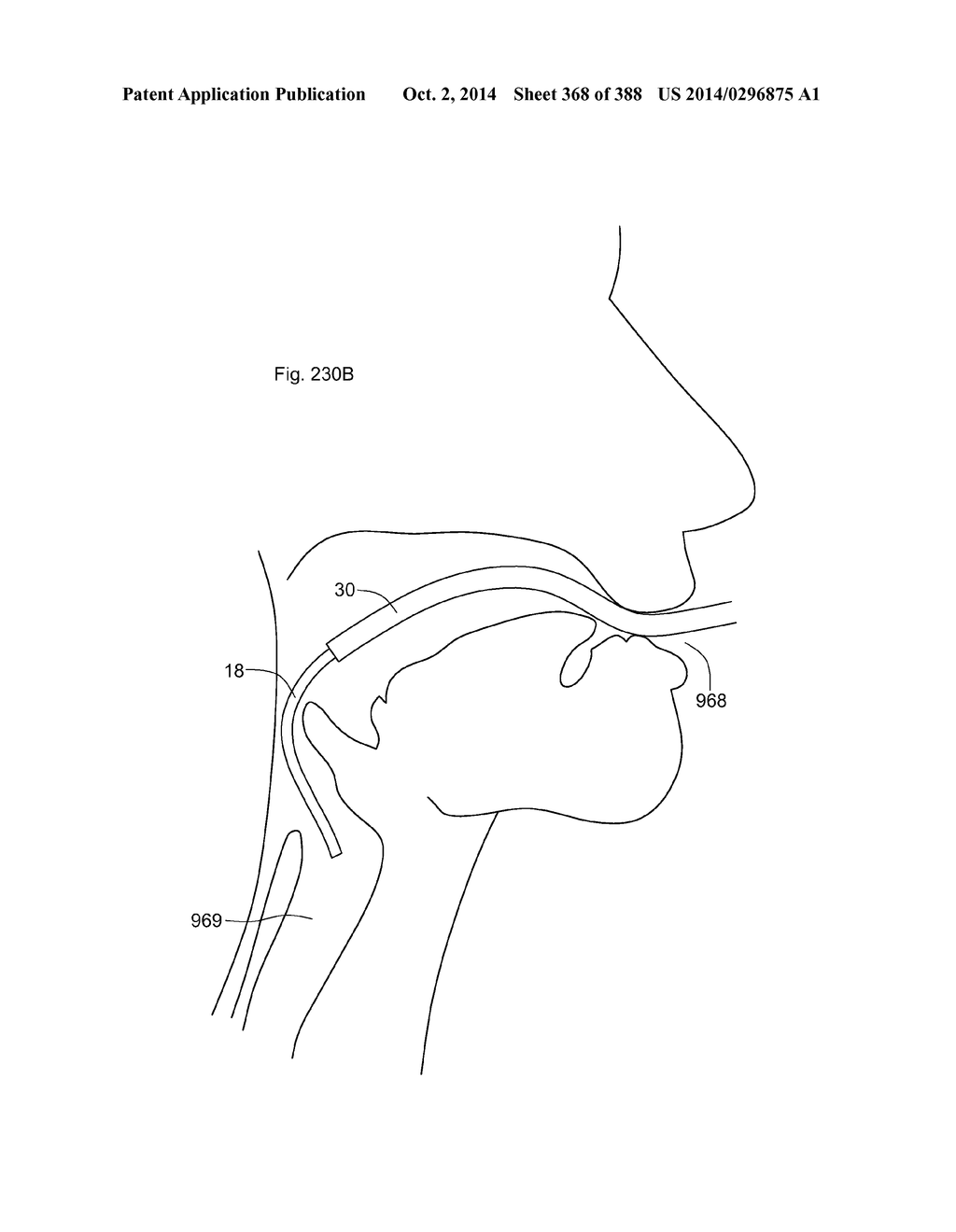 ROBOTIC CATHETER SYSTEM AND METHODS - diagram, schematic, and image 369