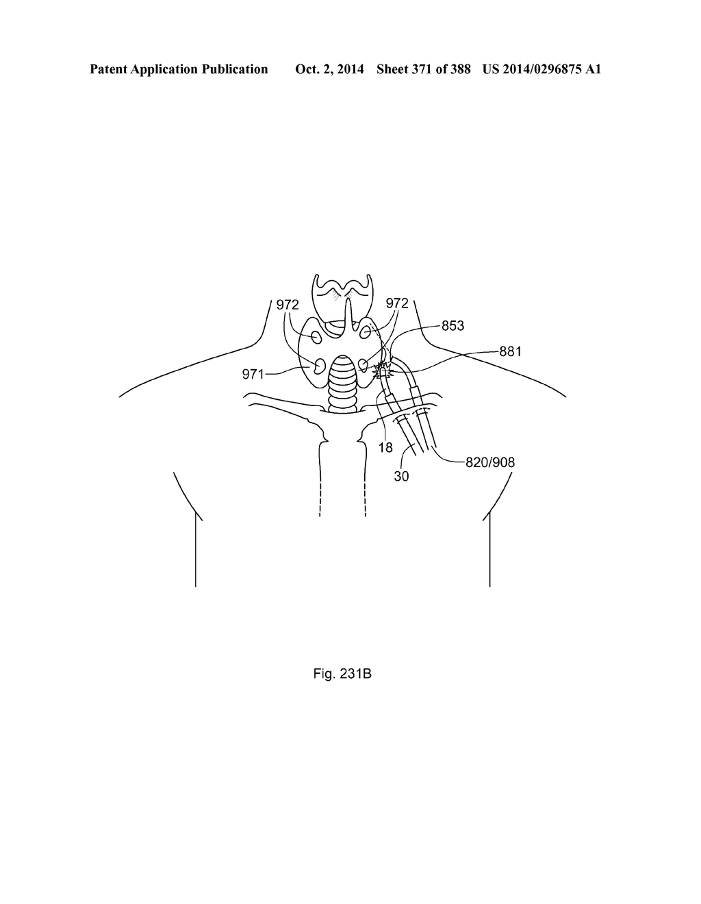 ROBOTIC CATHETER SYSTEM AND METHODS - diagram, schematic, and image 372