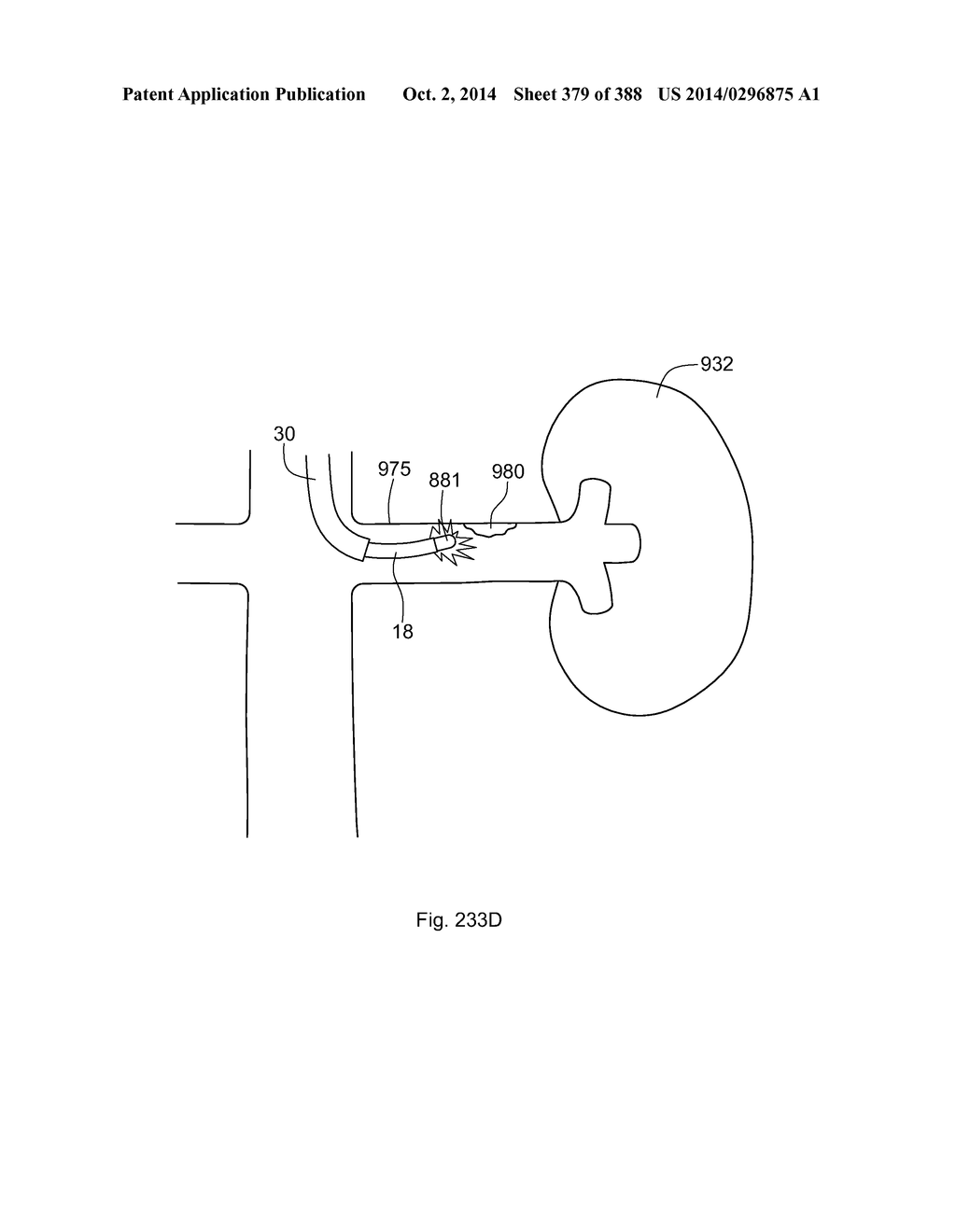 ROBOTIC CATHETER SYSTEM AND METHODS - diagram, schematic, and image 380