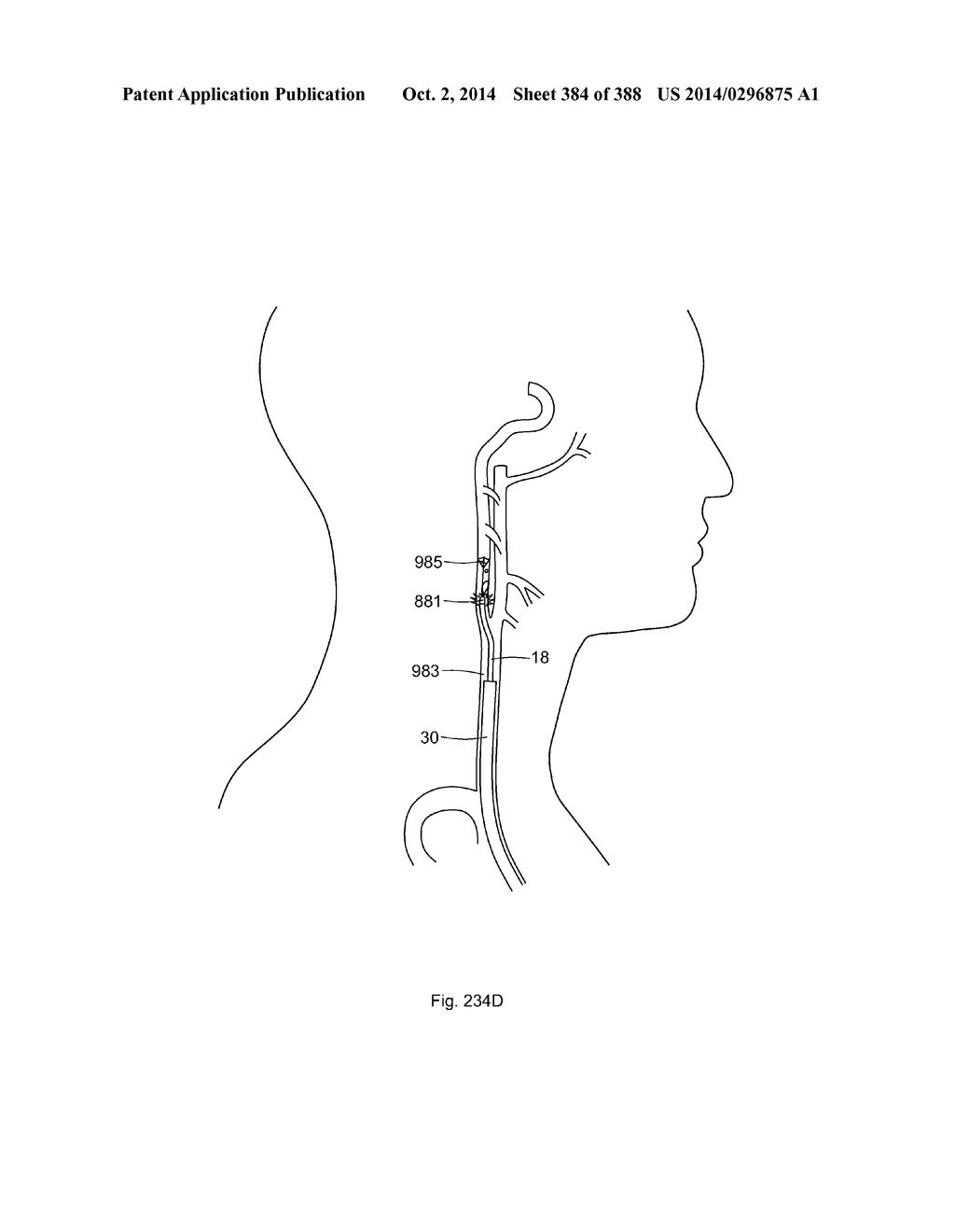 ROBOTIC CATHETER SYSTEM AND METHODS - diagram, schematic, and image 385