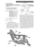 DEVICES, SYSTEMS AND METHODS USEABLE FOR TREATING SINUSITIS diagram and image