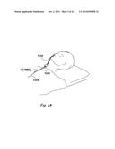 DEVICES, SYSTEMS AND METHODS USEABLE FOR TREATING SINUSITIS diagram and image