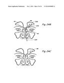 DEVICES, SYSTEMS AND METHODS USEABLE FOR TREATING SINUSITIS diagram and image