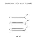 DEVICES, SYSTEMS AND METHODS USEABLE FOR TREATING SINUSITIS diagram and image