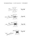 DEVICES, SYSTEMS AND METHODS USEABLE FOR TREATING SINUSITIS diagram and image