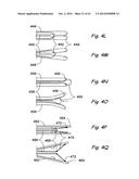 DEVICES, SYSTEMS AND METHODS USEABLE FOR TREATING SINUSITIS diagram and image