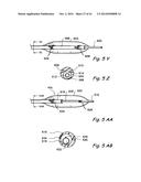 DEVICES, SYSTEMS AND METHODS USEABLE FOR TREATING SINUSITIS diagram and image