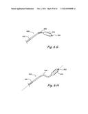 DEVICES, SYSTEMS AND METHODS USEABLE FOR TREATING SINUSITIS diagram and image