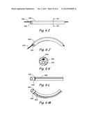 DEVICES, SYSTEMS AND METHODS USEABLE FOR TREATING SINUSITIS diagram and image