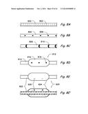 DEVICES, SYSTEMS AND METHODS USEABLE FOR TREATING SINUSITIS diagram and image