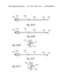 DEVICES, SYSTEMS AND METHODS USEABLE FOR TREATING SINUSITIS diagram and image