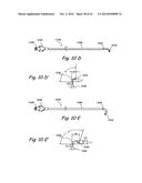 DEVICES, SYSTEMS AND METHODS USEABLE FOR TREATING SINUSITIS diagram and image