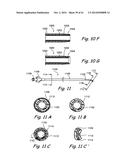 DEVICES, SYSTEMS AND METHODS USEABLE FOR TREATING SINUSITIS diagram and image