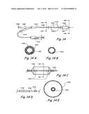 DEVICES, SYSTEMS AND METHODS USEABLE FOR TREATING SINUSITIS diagram and image