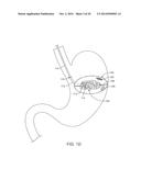 METHODS AND DEVICES FOR DEPLOYING AND RELEASING A TEMPORARY IMPLANT WITHIN     THE BODY diagram and image