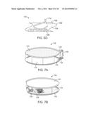 METHODS AND DEVICES FOR DEPLOYING AND RELEASING A TEMPORARY IMPLANT WITHIN     THE BODY diagram and image