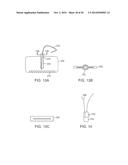 METHODS AND DEVICES FOR DEPLOYING AND RELEASING A TEMPORARY IMPLANT WITHIN     THE BODY diagram and image