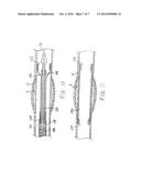 APPARATUS AND METHODS FOR IN SITU EMBOLIC PROTECTION diagram and image