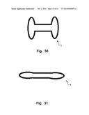 Medical Implant, A Kit And A Method Of Manufacturing A 3D Fabric Of     Strands For Forming A Medical Implant diagram and image