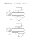 Tissure Closure Device and Method diagram and image