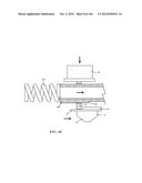 Tissure Closure Device and Method diagram and image