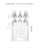 Tissure Closure Device and Method diagram and image