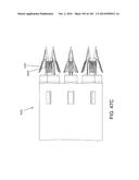 Tissure Closure Device and Method diagram and image